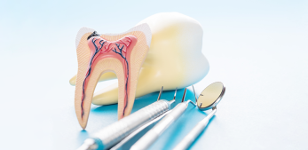 Endodonti - Kök Kanalı Tedavileri